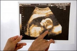 Маловодие: чем опасно? Статьи Маловодие: чем опасно? Статьи