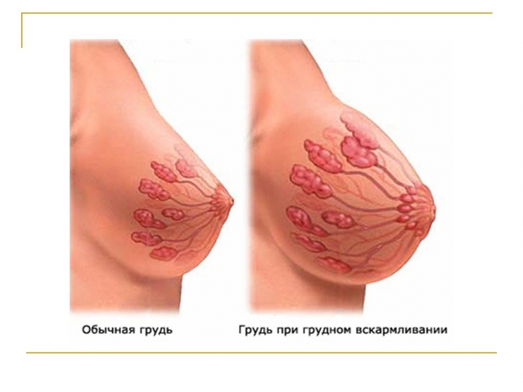 Трансвеститы увеличение груди